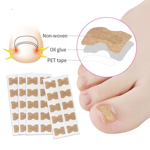 Ingrown Toenail Corrector Stickers, Ingrown Toenail Pain Reliever Softens Nails for Easy Trimming, Foot Care
